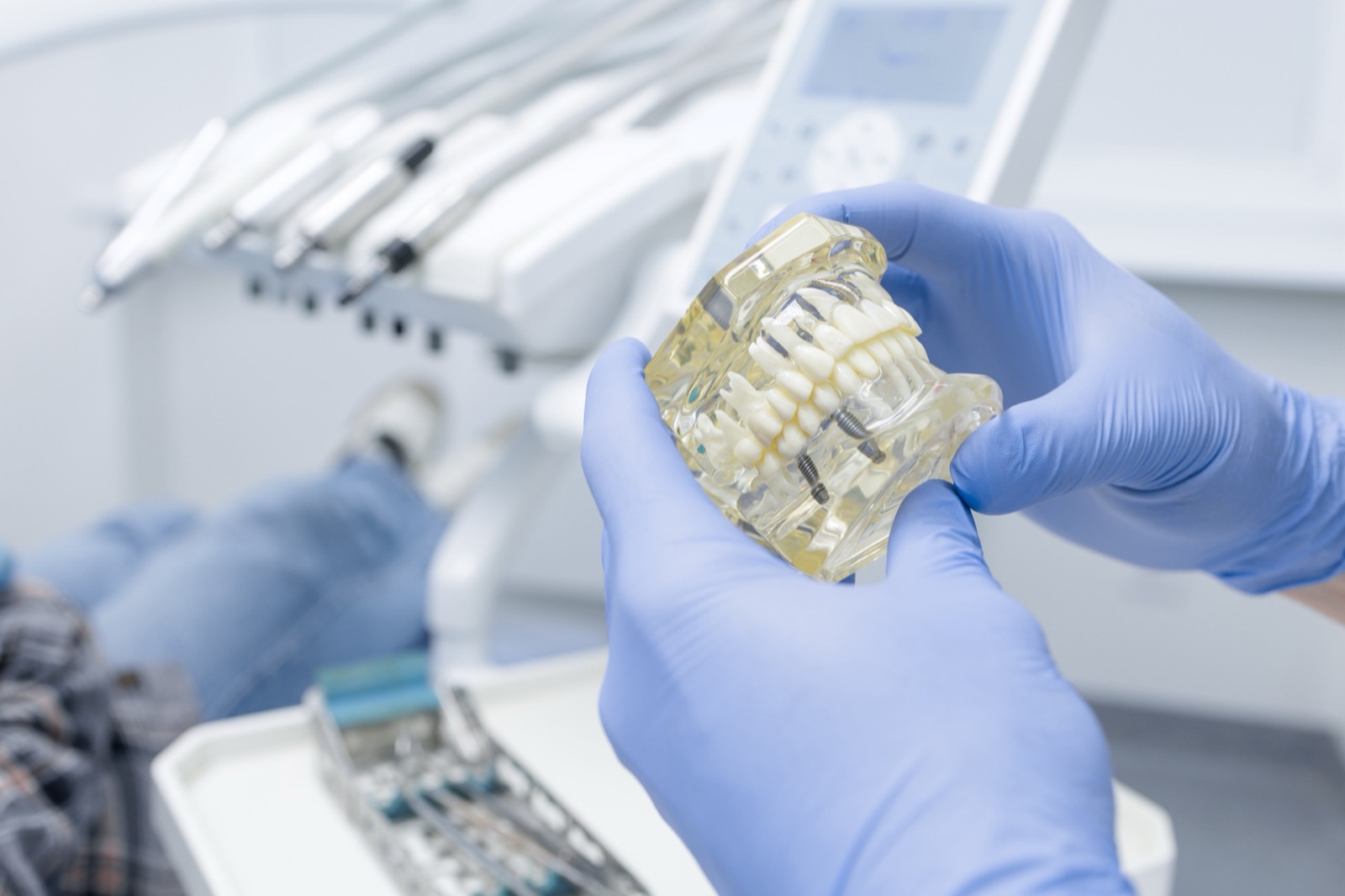 Dental implant model showing advanced prosthodontic treatment